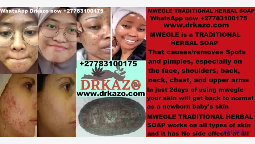 Z$025 Mwegle traditional herbal soap for spots and pimples, especially on the face, neck, chest